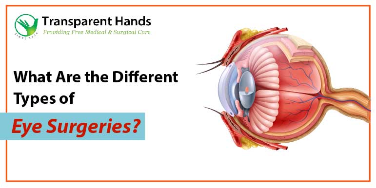 What are the different types of Eye Surgeries?