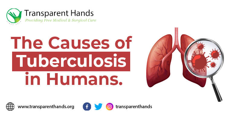 Symptoms of Tuberculosis