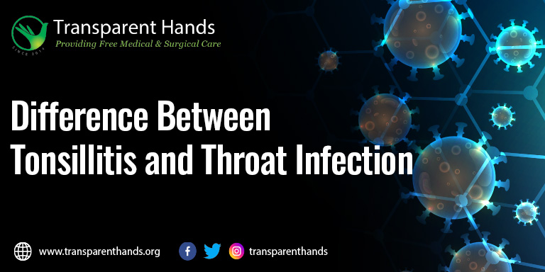 Difference between Tonsillitis and Throat Infection