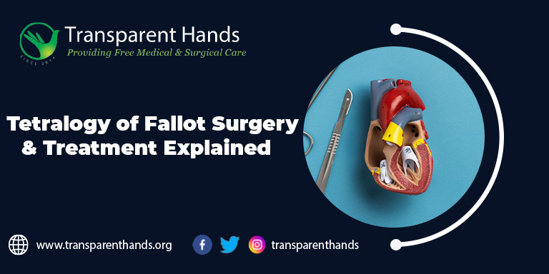 Tetralogy of Fallot surgery
