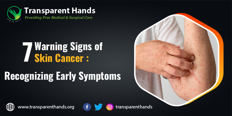 Warning Signs of Skin Cancer: Recognizing Early Symptoms